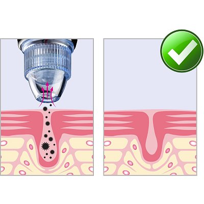 LADY TWO ČISTIČ PLETI VIGAN